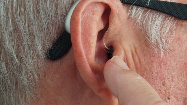 Cena aparatu słuchowego – co się na nią składa?